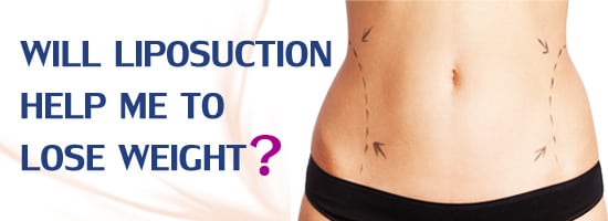 Will-Liposuction-Help-Me-to-Lose-Weight-Sep-13-Crown-Valley-Surgical-Center