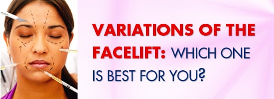 Variations-Of-The-Facelift-Which-One-Is-Best-For-You-Crown-Valley-Surgical-Center