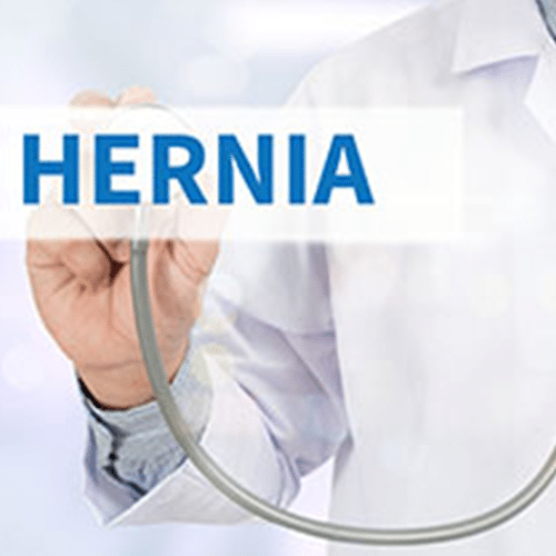 Hiatal-Hernia-Repair-Crown-Valley-Surgical-Center