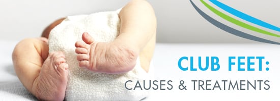 Club-Feet-Causes-and-Treatments-Crown-Valley-Surgical-Center