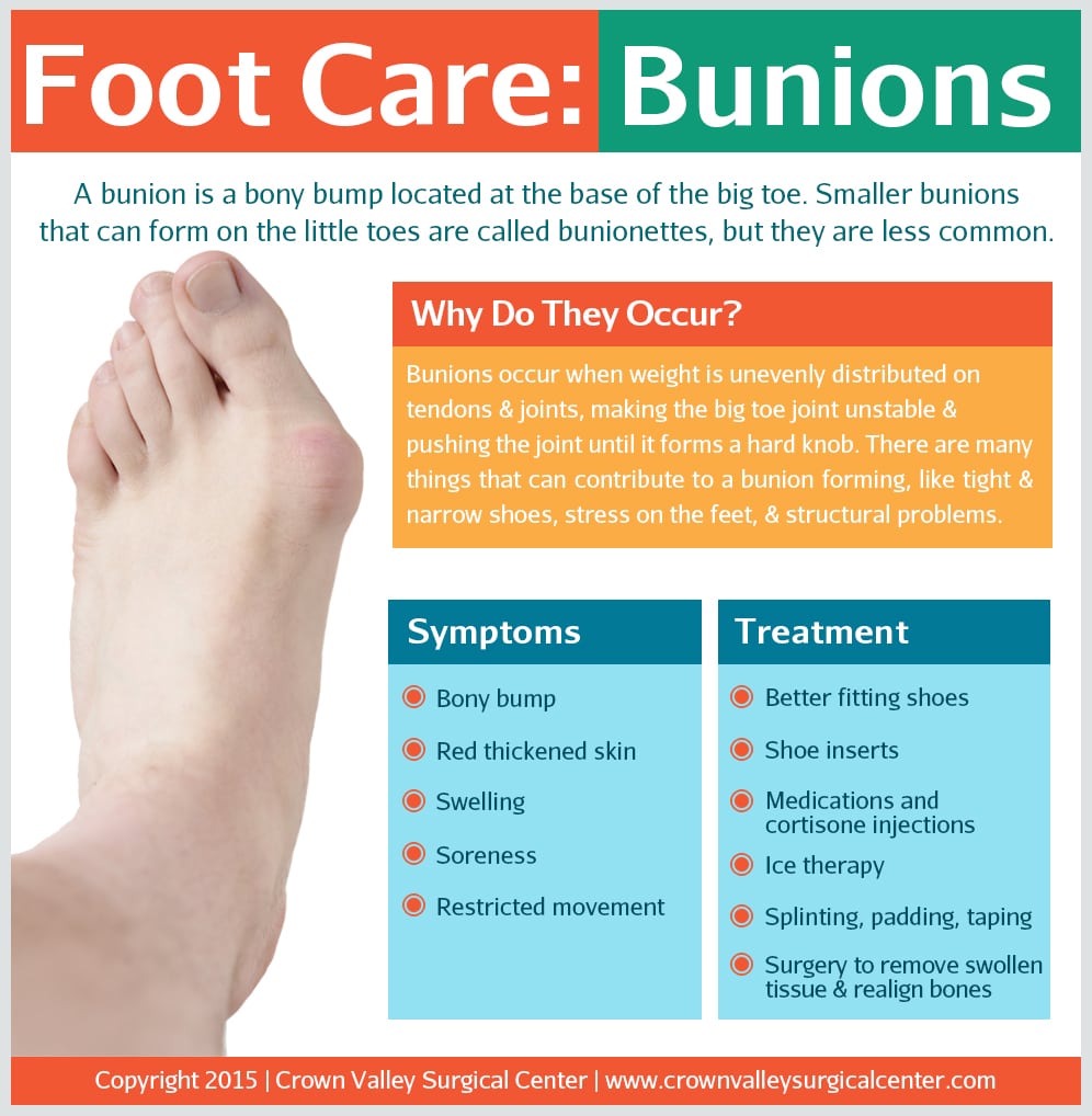 Foot-Care-Bunions-by-Crown-Valley-Surgical-Center