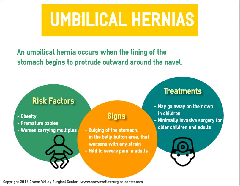 Umbilical Hernia Surgery Orange County