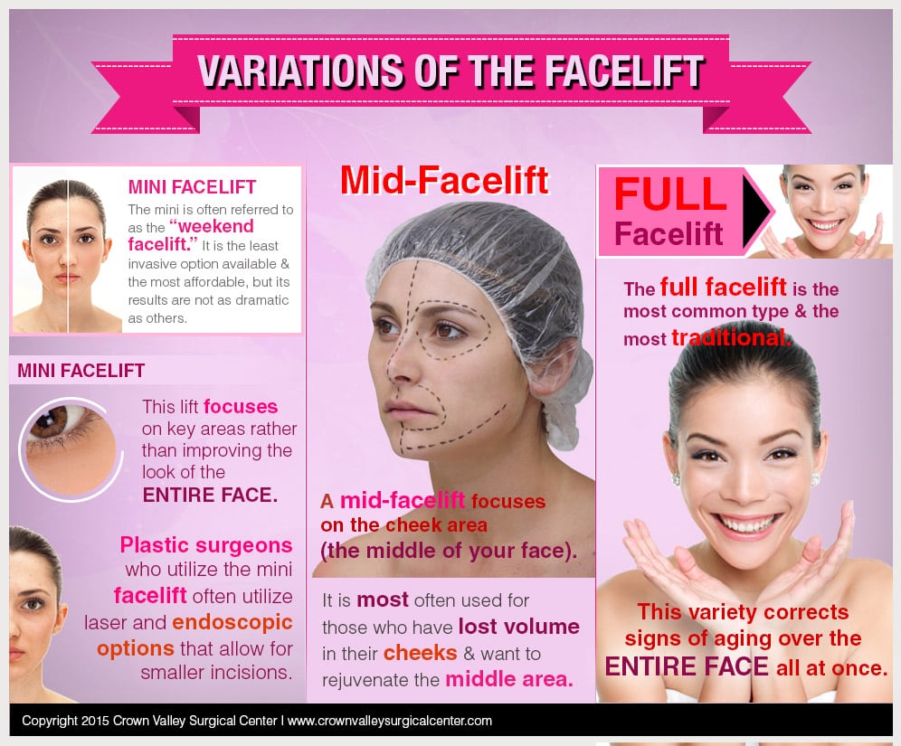 variations-of-the-facelift
