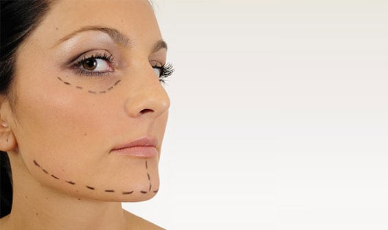 Face-Lift-Orange-County-Crown-Valley-Surgical-Center