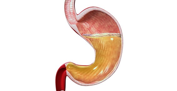 Stomach-Endoscopy-1-Crown-Valley-Surgical-Center