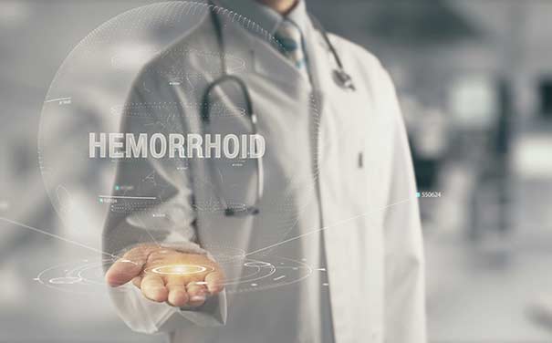 Hemorrhoid-Surgery-Crown-Valley-Surgical-Center