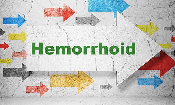 Hemorrhoid-Surgery-Crown-Valley-Surgical-Center