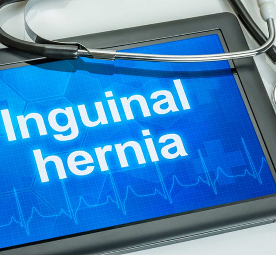 medical-concept-of-inguinal-hernia-Crown-Valley-Surgical-Center