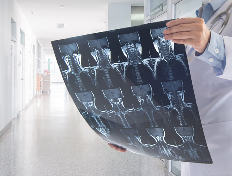 Physician-analyzing-x-ray-scan-to-determine-if-patient-needs-a-minimally-invasive-spine-procedure